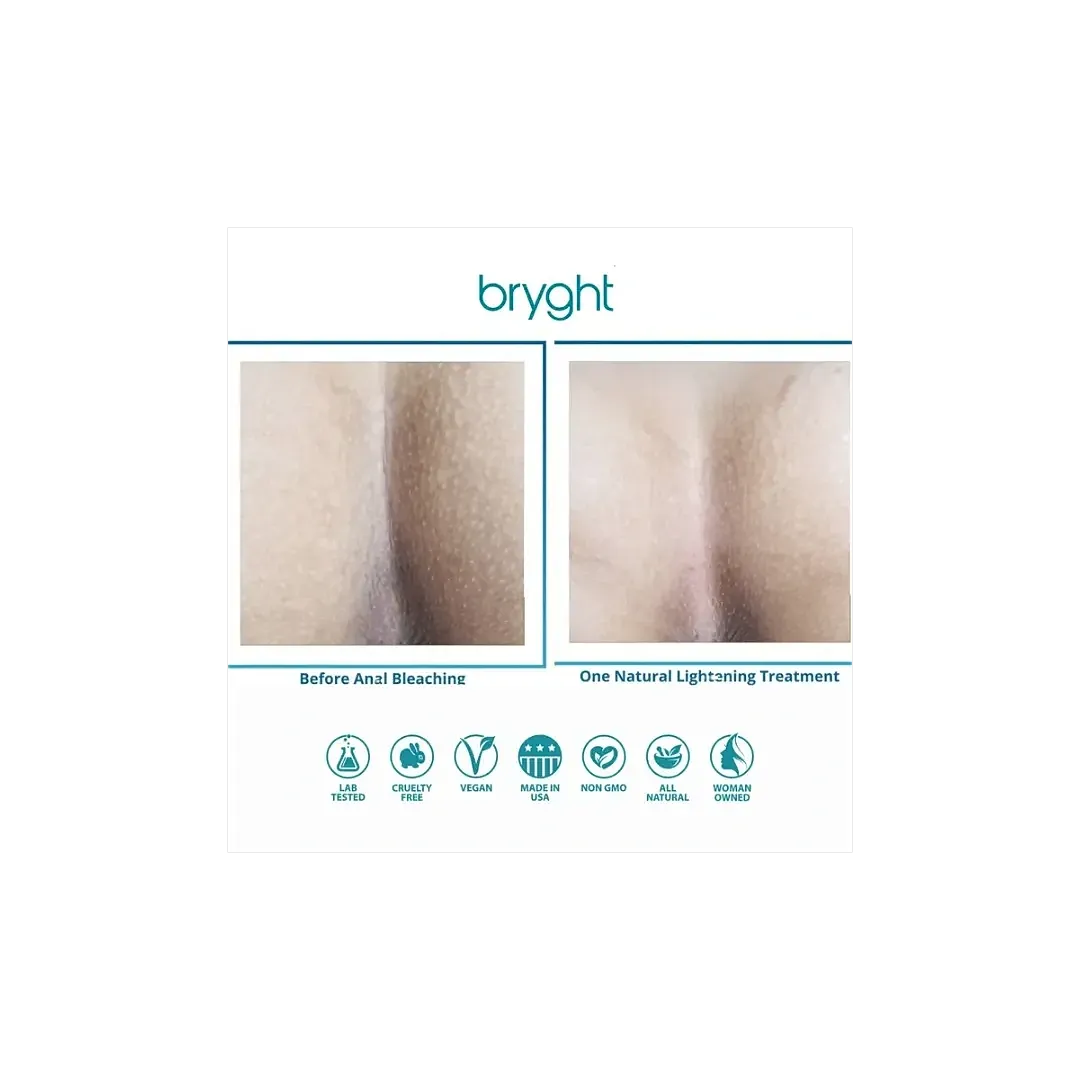 Before and after anal lightening treatment comparison.